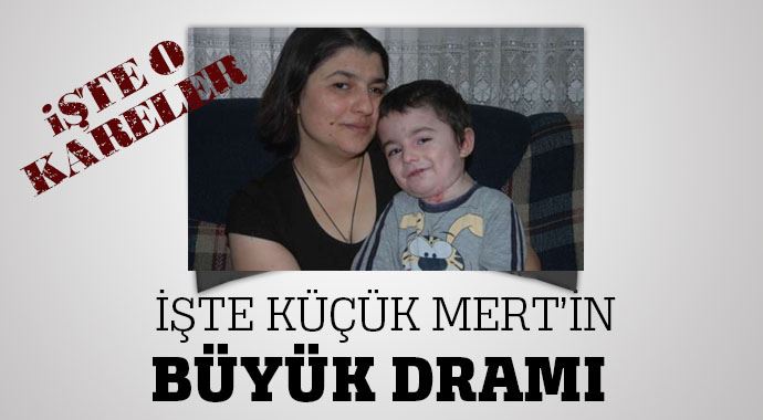 Küçük Mert'in derdi çok büyük