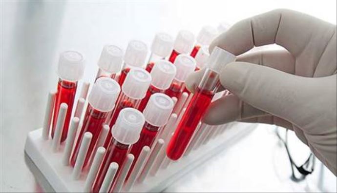 Müthiş buluş! Ölümü tahmin eden test!
