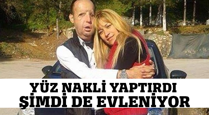 Yüz nakli yaptıran Recep Sert hastanede nişanlandı Yüz nakli yaptıran Recep Sert hastanede nişanlandı