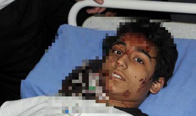 Okula havan topu düştü, 14 ölü