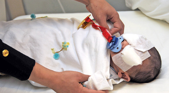 13 günlük bebeğe katarakt ameliyatı 13 günlük bebeğe katarakt ameliyatı