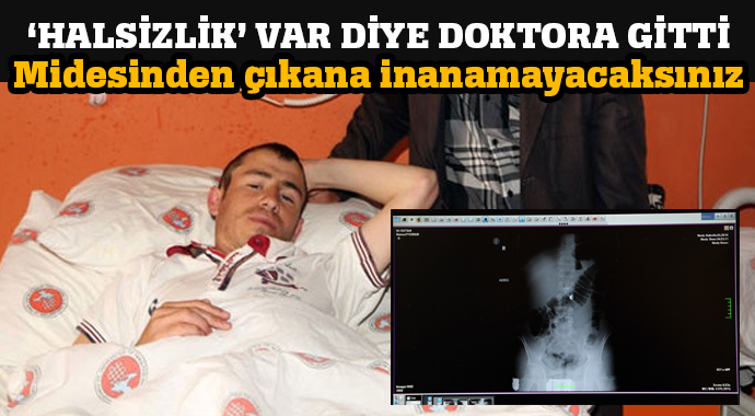 Midesinden çıkana şaşıracaksınız! Midesinden çıkana şaşıracaksınız!