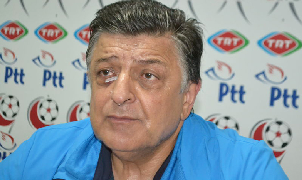 Yılmaz Vural'ın gözünü morarttılar Yılmaz Vural'ın gözünü morarttılar