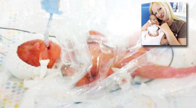 Sandviç bebeği! 12 hafta poşette büyüdü