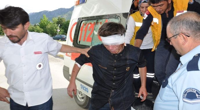 Yanında çalışan kişinin kulağını ısırdı Yanında çalışan kişinin kulağını ısırdı
