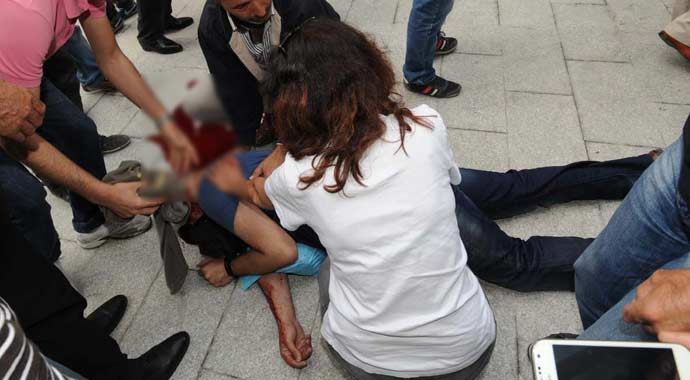İstanbul Emniyeti'nden yaralı vatandaş açıklaması İstanbul Emniyeti'nden yaralı vatandaş açıklaması