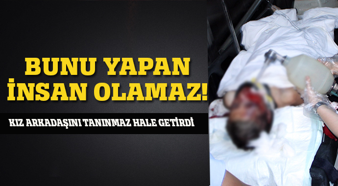 Muğla'da sevgili dehşeti! Falçatayla saldırdı... Muğla'da sevgili dehşeti! Falçatayla saldırdı...