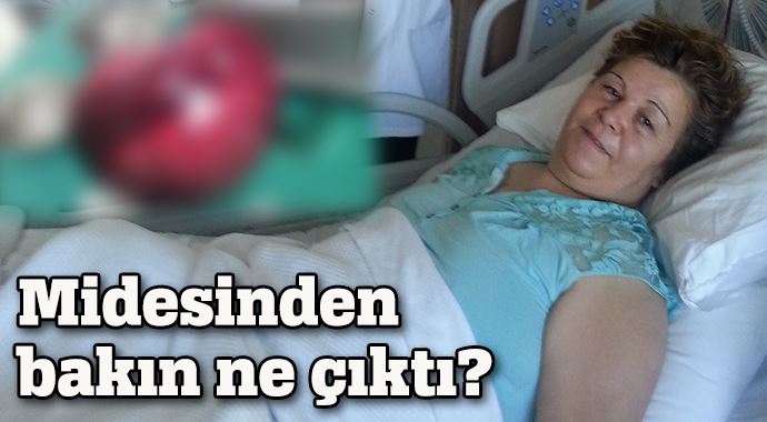 Karnından 5 kilo kitle çıkarıldı