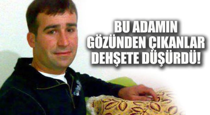 Bu adamın gözünden çıkanlar dehşete düşürdü!