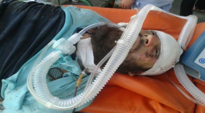 Türkiye sınırında patlama: 40 ölü, 60 yaralı