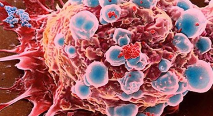 Ebola ülkedeki tüm okulları kapattırdı