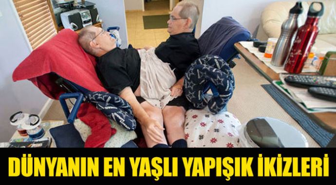 Dünyanın en yaşlı yapışık ikizleri