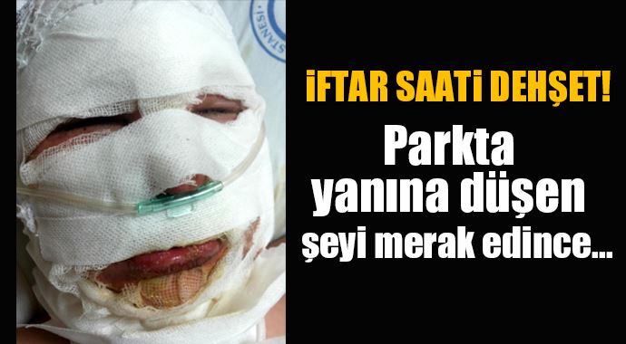 Atılan iftar topu elinde patladı Atılan iftar topu elinde patladı