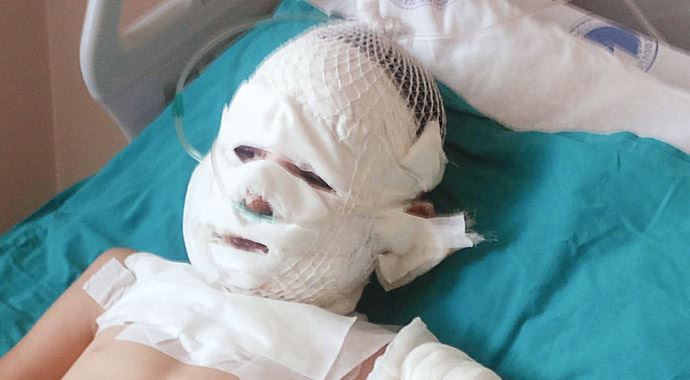 Ses bombası elinde patladı