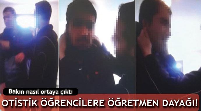 Profesörün otistik çocuklarına öğretmen dayağı