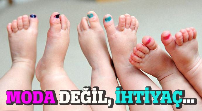 Üçüzleri ayırmaya ojeli metot