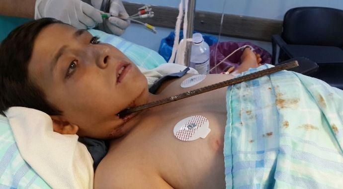 Boynuna saplanan demirle hastaneye geldi