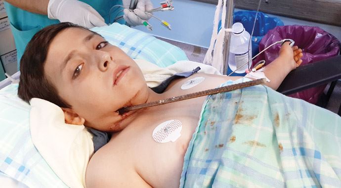 1 milimle hayata tutundu 1 milimle hayata tutundu