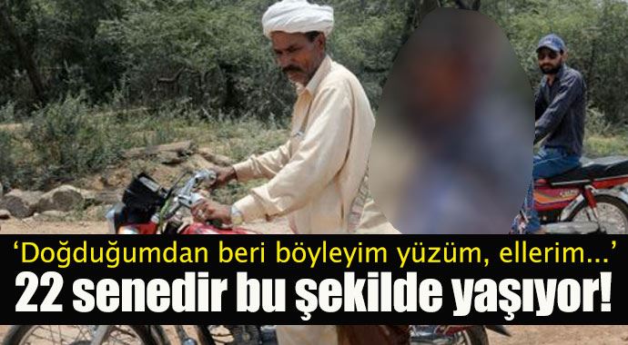 22 yıldır böyle yaşıyor! 22 yıldır böyle yaşıyor!