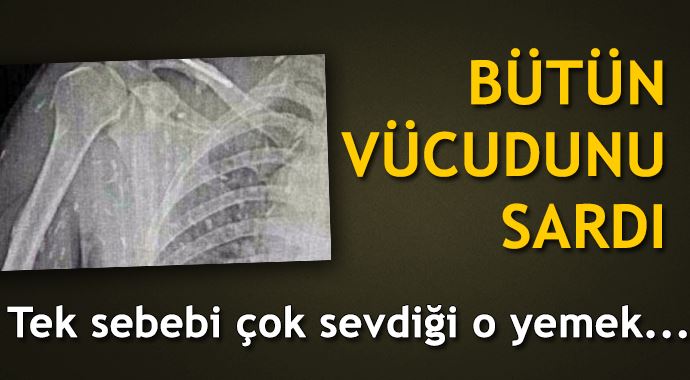 Bütün vücudunu kurtlar sardı