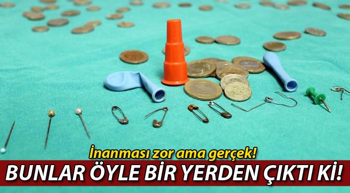 Nefes borusundan çıkanlara inanamayacaksınız! Nefes borusundan çıkanlara inanamayacaksınız!