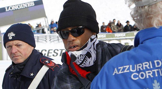 Ünlü golfçü Tiger Woods, kamera yüzünden dişinden oldı Ünlü golfçü Tiger Woods, kamera yüzünden dişinden oldı