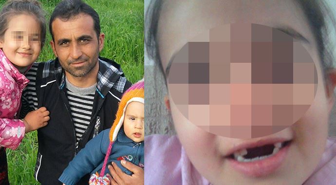Çocuğunun kalıcı dişlerinin çekildiğini söyleyen baba şikayetçi Çocuğunun kalıcı dişlerinin çekildiğini söyleyen baba şikayetçi