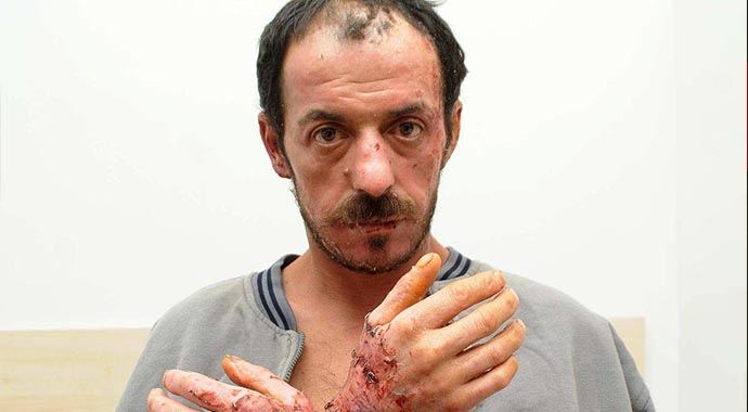 Oğlu sopayla vurdu, eşi benzin döküp yaktı Oğlu sopayla vurdu, eşi benzin döküp yaktı