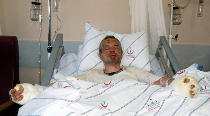 Banyoda sigara içmek istedi, ölümden döndü Banyoda sigara içmek istedi, ölümden döndü