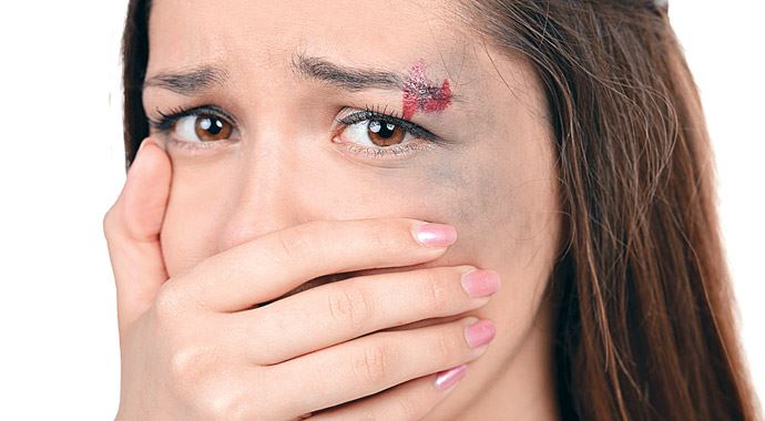 Şiddet mağduru kadına estetik desteği Şiddet mağduru kadına estetik desteği