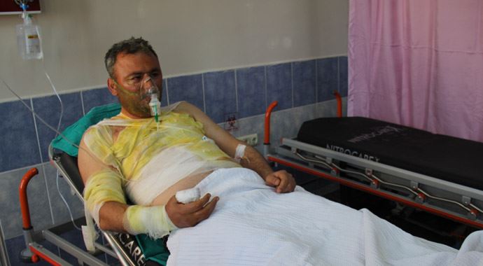 Sivas'ta çakmak gazı tüpü patladı: 1 yaralı Sivas'ta çakmak gazı tüpü patladı: 1 yaralı