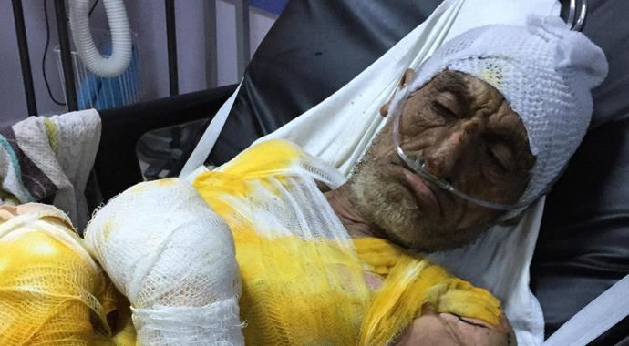 Alevlerin arasında kalan yaşlı adamın durumu ağır