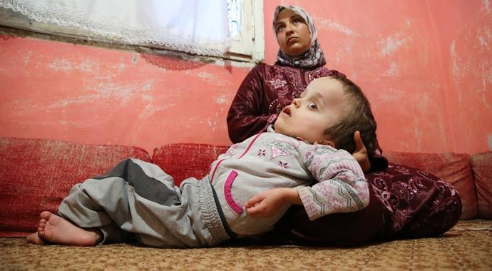 Vücudu 9 başı, 11 kilo! Vücudu 9 başı, 11 kilo!