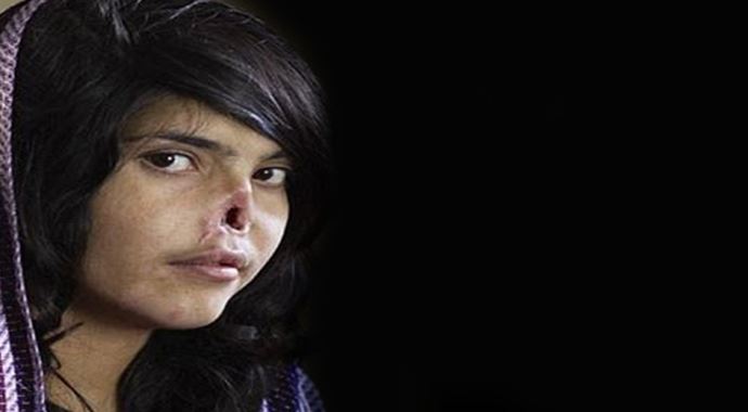 Afgan kadın Ayşe yeni burnuna kavuştu, işte o görüntüsü... Afgan kadın Ayşe yeni burnuna kavuştu, işte o görüntüsü...