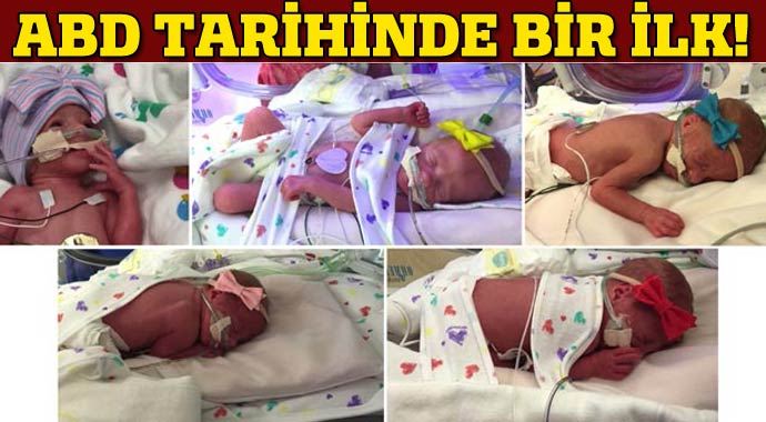 ABD&#039;de tarihinde ilk beşiz kız bebek