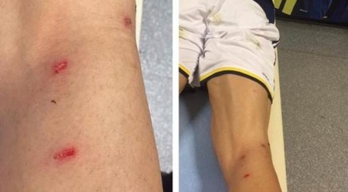 Fenerbahçe&#039;den sert hareket isyanı!