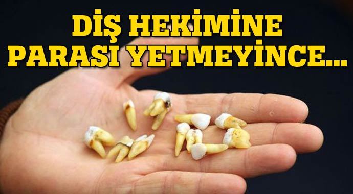 Diş hekimine parası yetmeyince hepsini kendi çekti Diş hekimine parası yetmeyince hepsini kendi çekti