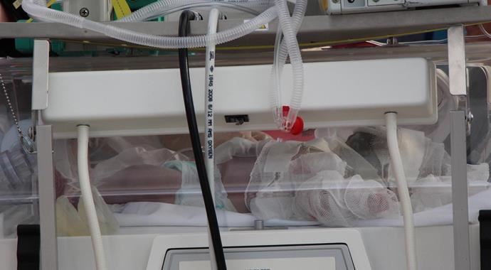 Isınsın diye yenına saç kurutma makinesi konulan bebek yandı Isınsın diye yenına saç kurutma makinesi konulan bebek yandı