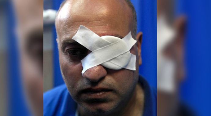 İsrail askerleri Filistinli foto muhabiri gözünden yaraladı İsrail askerleri Filistinli foto muhabiri gözünden yaraladı