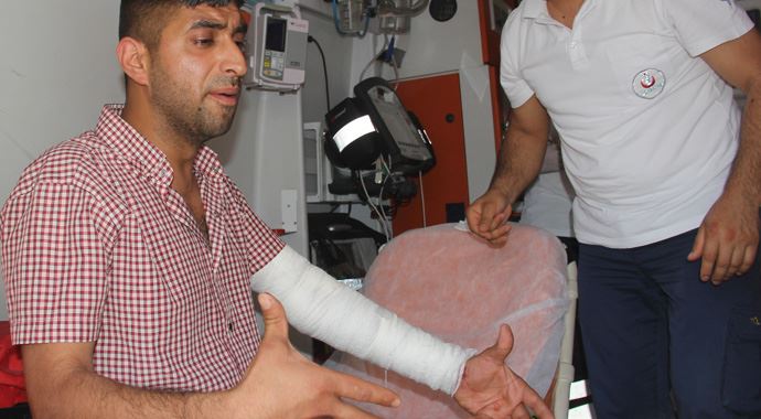 Bıçakla kendini kesti! &#039;Bu benim hobim&#039;