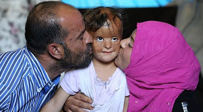 Suriyeli Fatma'nın gözü Türk doktorlarında