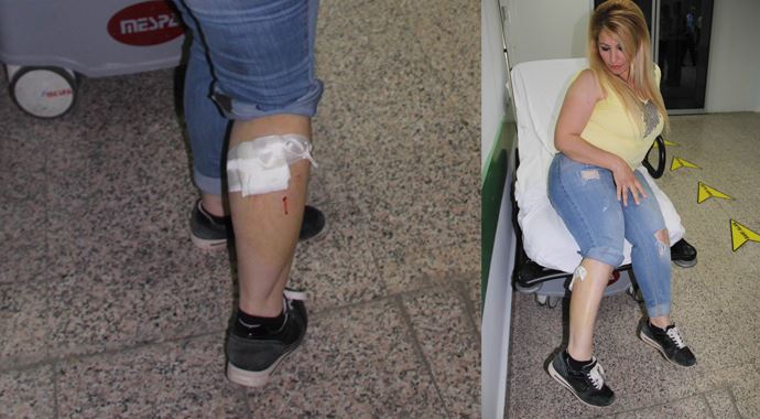 Köpeklerin saldırdığı kadın hastanelik oldu
