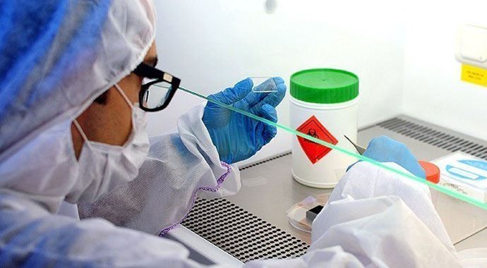 Giresun&#039;da 4 kişiye &quot;şarbon&quot; teşhisi