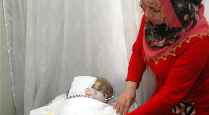 Aleyna'nın durumu gün geçtikçe kötüye gidiyor