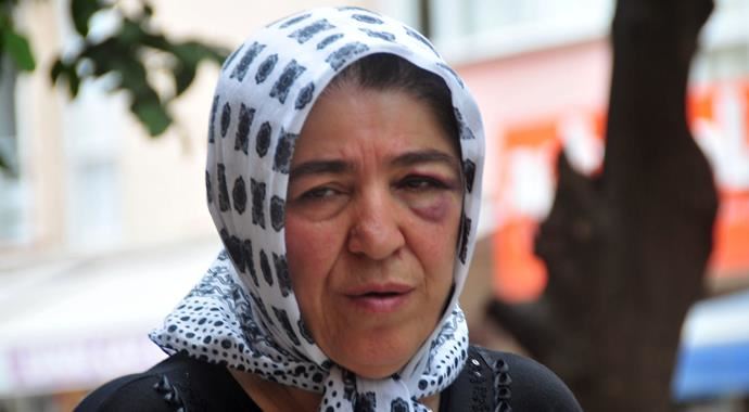 Cadde ortasında annesini döve döve bu hale getirdi!