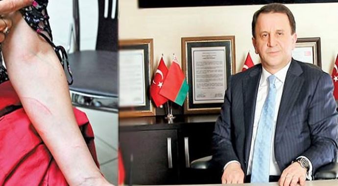 Korkunç iddia! &#039;CHP&#039;li başkan tekme tokat dövdü&#039; 