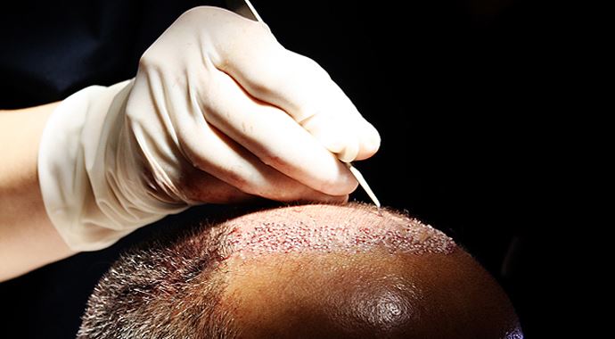 Türkiye merkez oldu! Türkiye merkez oldu!