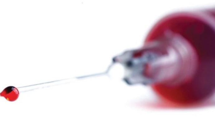 Bir damla kanla, &#039;virüs tarihi&#039; belli olacak