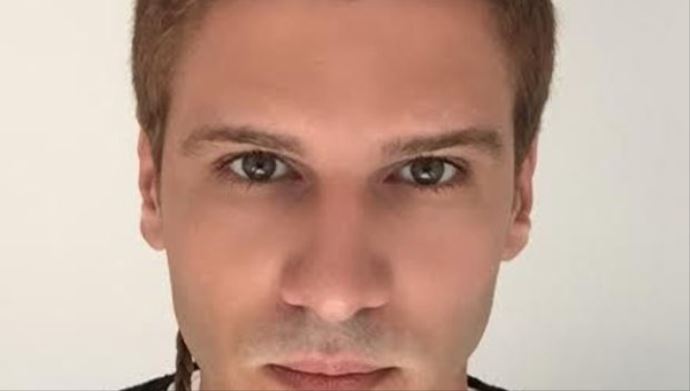 Tolgahan Sayışman'ın yeni hali şaşırttı! Tolgahan Sayışman'ın yeni hali şaşırttı!