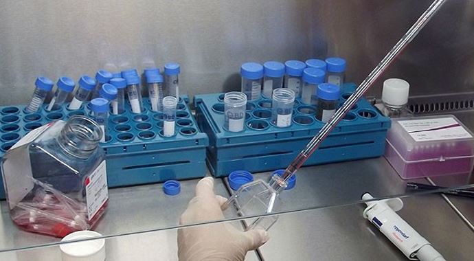 80 yaşındaki hastaya kök hücre nakli 80 yaşındaki hastaya kök hücre nakli